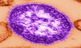 Above, BC Centre for Disease Control's (BCCDC's) electron microscope image of measles virus. (In reality the measles virus is not purple; the purple colour is added as visual aid.)